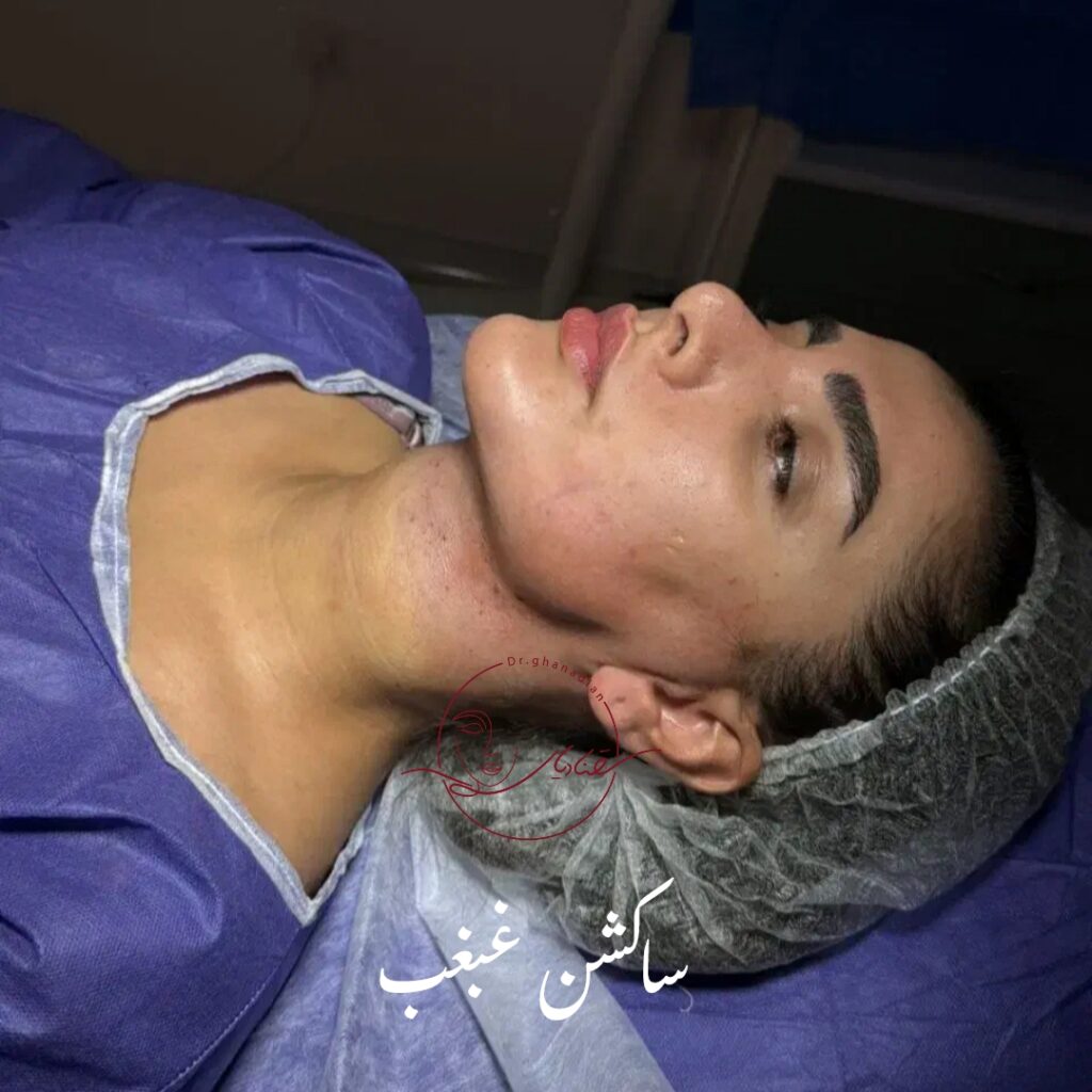 نمونه کار لیپوساکشن غبغب